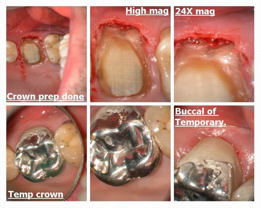 Resize of Page 2 off osseous.jpg